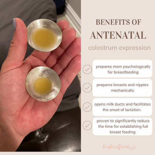 Benefits of Antenatal Colostrum Expression